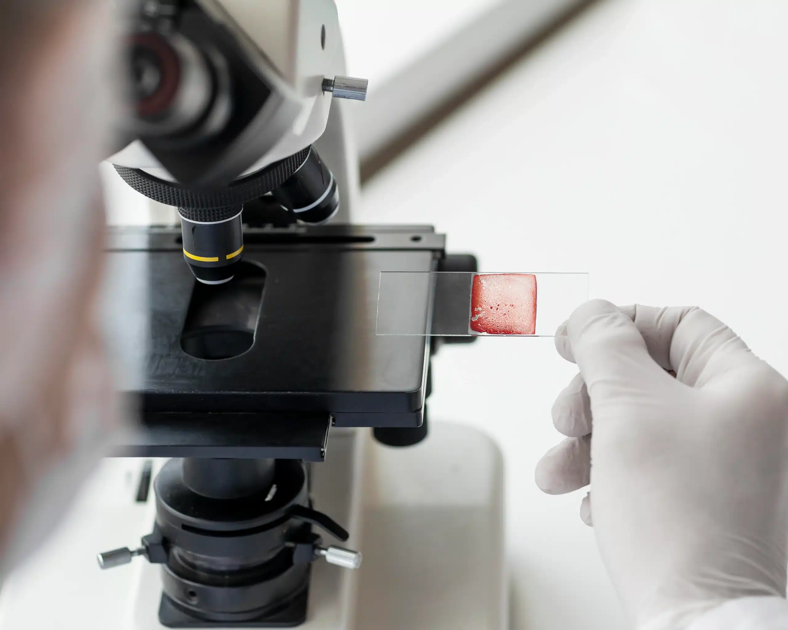 Máster Anatomía Patológica y Citodiagnóstico 1 Máster Anatomía Patológica y Citodiagnóstico