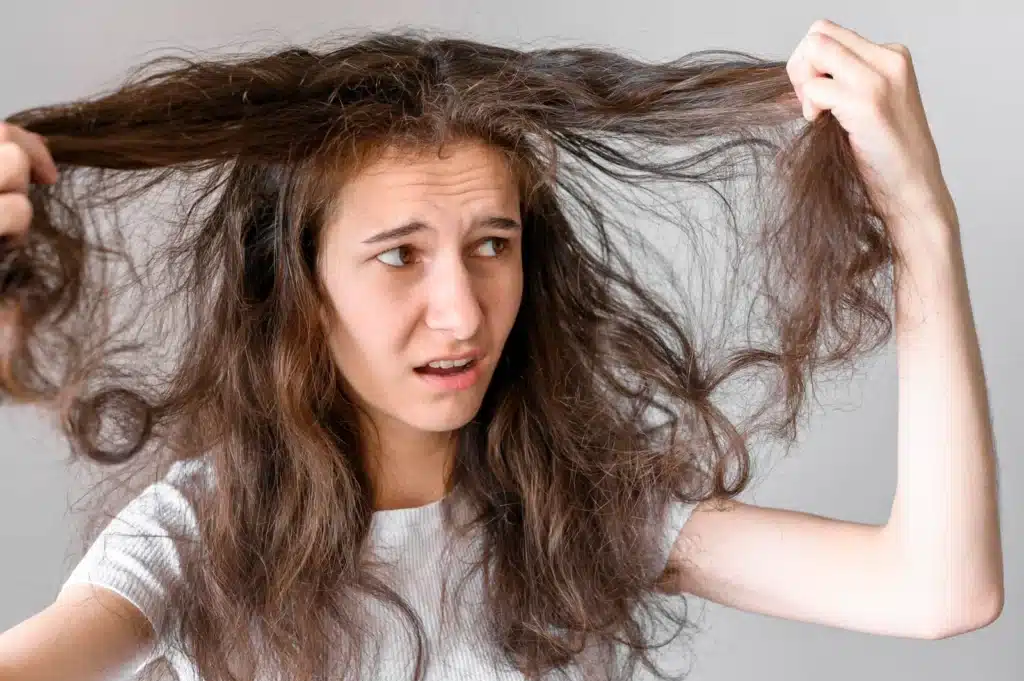 Mujer Preocupada por El Cabello Enredado
