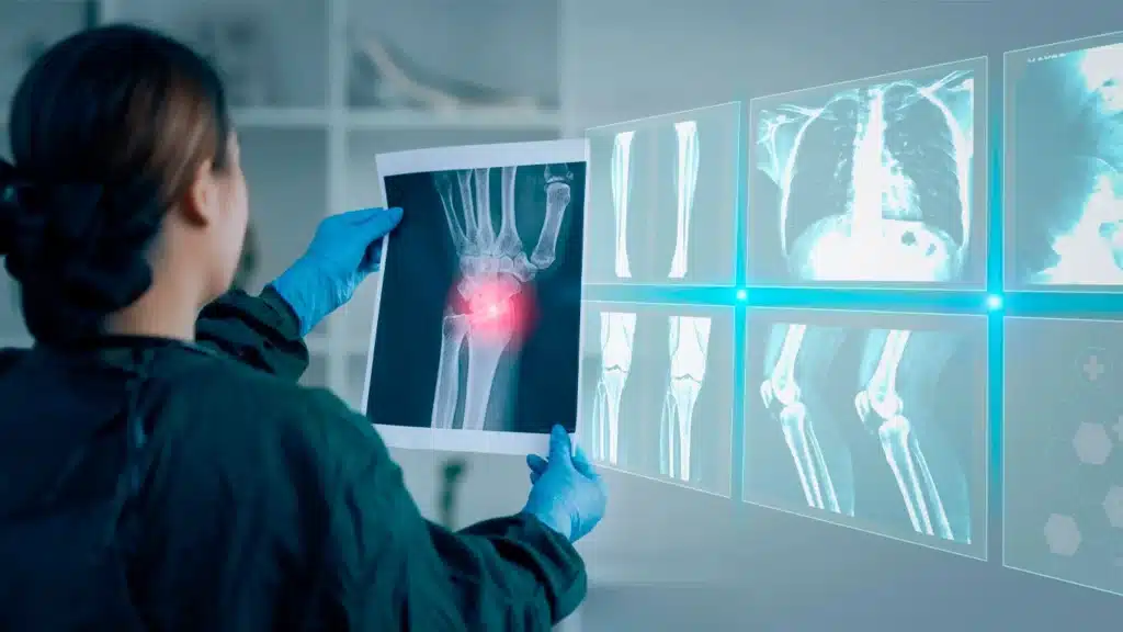 Radiologia Diagnotisco Precoz