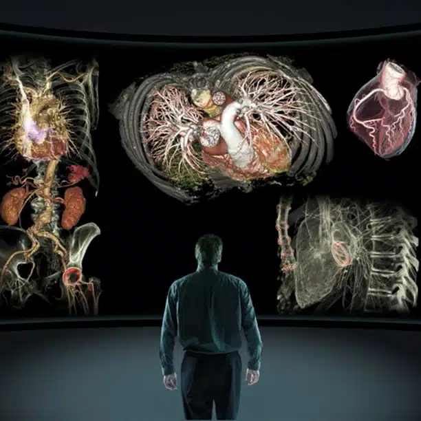 Qué es la radiología y qué salidas laborales tiene 6 vision-radiologia