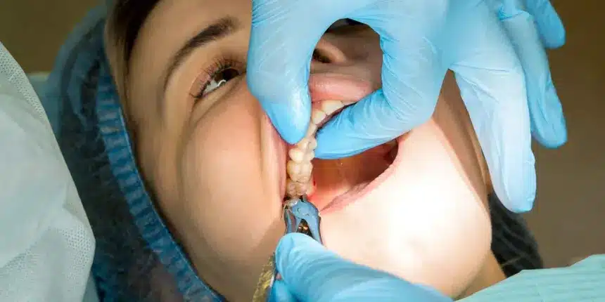 Dentista de la Seguridad Social: 5 tratamientos gratis que te ocultan 4 extraccion dental