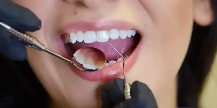 Dentista de la Seguridad Social: 5 tratamientos gratis que te ocultan 5 revision preventiva