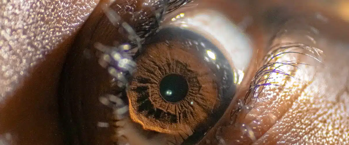 Lentes de contacto: tipos, cuidados y claves para gestionar una óptica 6 Detalle del iris de una persona bajo iluminación suave y natural